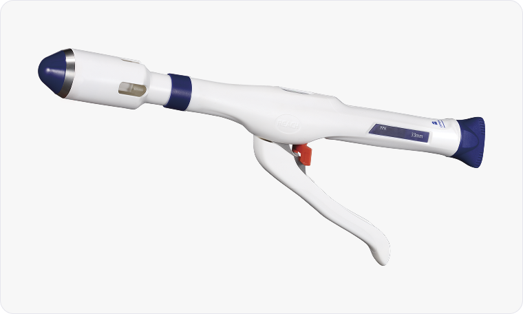 원형 자동 문합기 수술