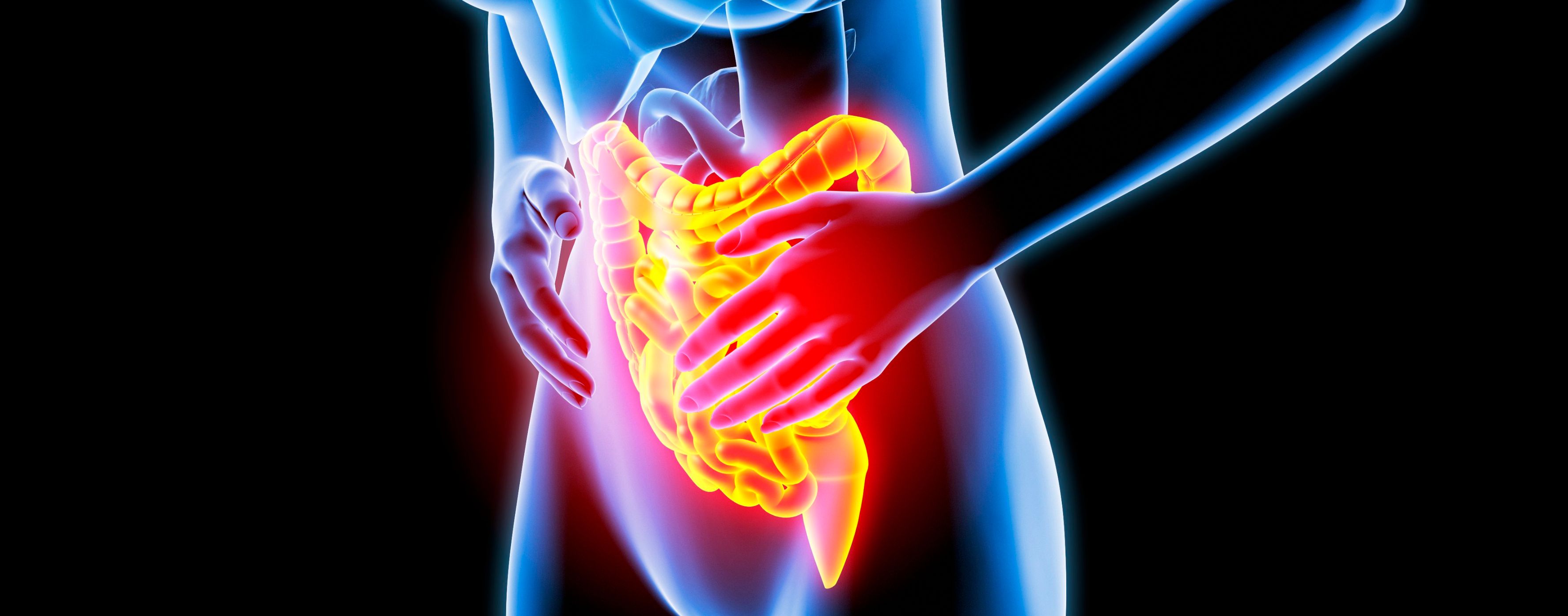 궤양성 대장염 이미지